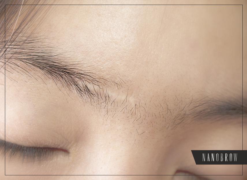 मेकअप से निशान छुपाना